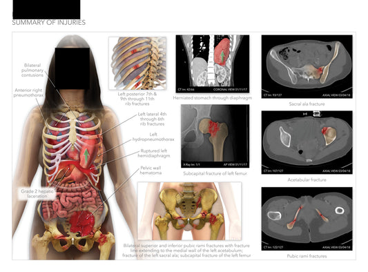 Using Illustrations in Personal Injury Demand Letters
